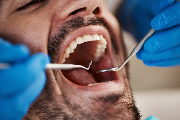 Best Chipped Tooth Repair Near Me  in Mystic, CT